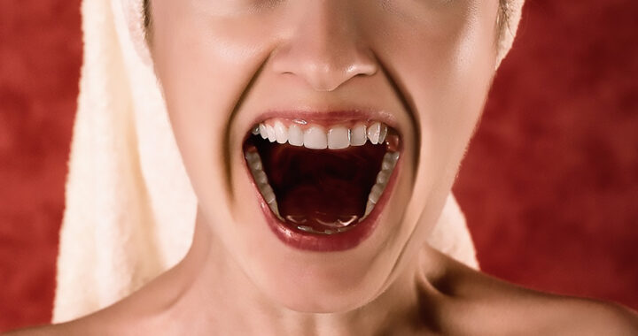 A tight-shot of a woman smiling with her mouth open for the article "Deactivating USAG-1: A Drug For Regrowing Teeth"